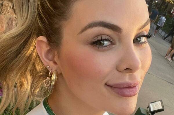 Modelo explicó qué pasó con sus labios