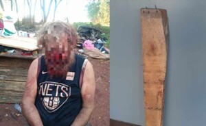 Brasileño fue golpeado por indígena con pedazo de madera con clavos