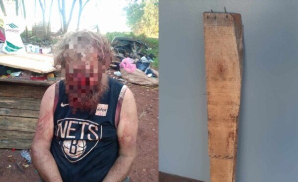 Brasileño fue golpeado por indígena con pedazo de madera con clavos