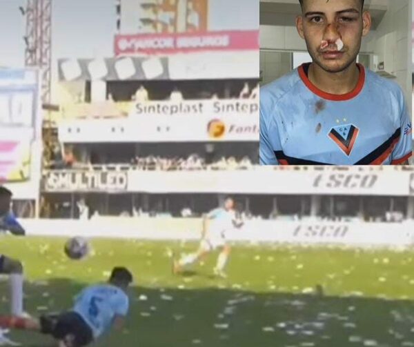 (VIDEO) Pelotero curepí sufre tremenda patada durante un partido