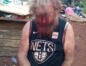 Indígena casi mata a golpes a un vagabundo brasileño – Diario TNPRESS