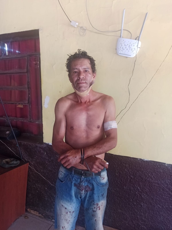 Hombre hiere con un arma blanca a su hermana y luego intenta suicidarse