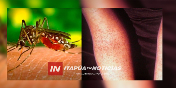 EPIDEMIA DE CHIKUNGUNYA Y DENGUE SE ADELANTARÍA ESTE AÑO, AFIRMÓ SEQUERA - Itapúa Noticias