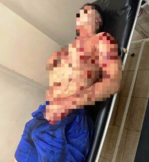 Mujer hiere a su pareja durante discusión - La Clave