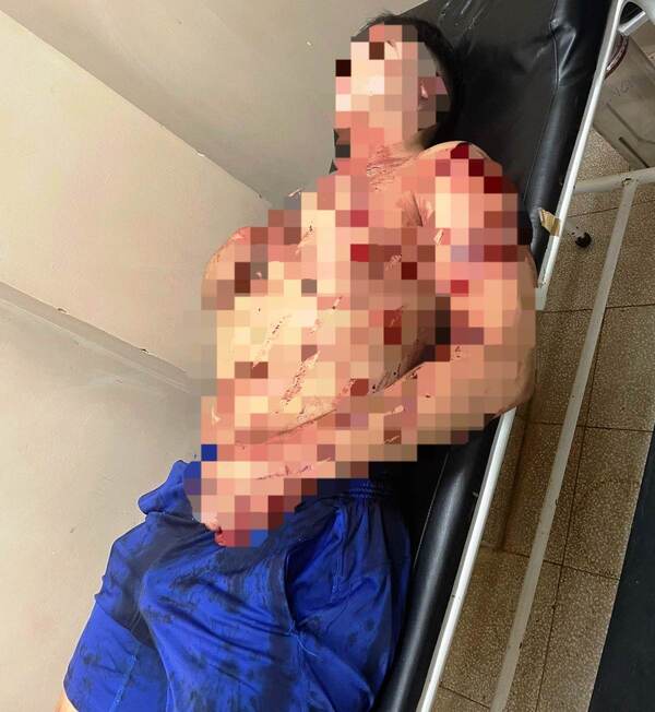 Mujer hiere a su pareja durante discusión - La Clave