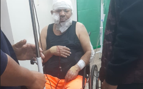 Guardia macheteado fue derivado a un hospital de Brasil