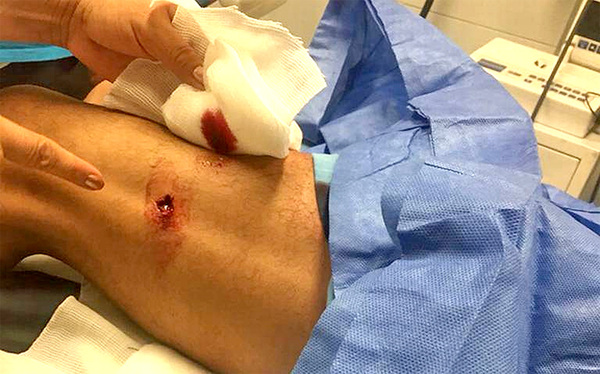 Delincuentes balean en la pierna a joven para robarle su motocicleta - La Clave