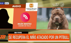 Se recupera el niño atacado por un pitbull | Telefuturo