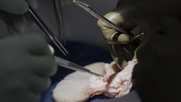 (VIDEO) ¡Riñón de chancho funciona en cuerpo humano!