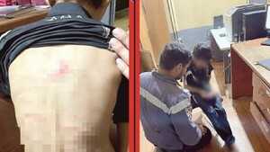Niño ligó con piola y se le encontró desnutrido