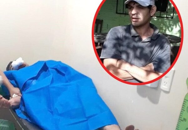 Sujeto con antecedentes es baleado en la boca, pero escapa de hospital – Diario TNPRESS