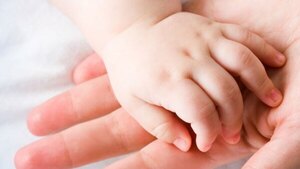 Triste: Falleció segundo bebé siamés