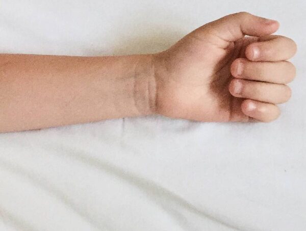 Ñemby: Muere niña de cuatro años asfixiada por una cortina · Radio Monumental 1080 AM