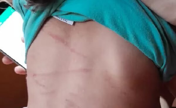 Niña de dos años fue brutalmente golpeada por su papá - Noticiero Paraguay