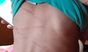 Hernandarias: Niña de dos años brutalmente golpeada por su padre