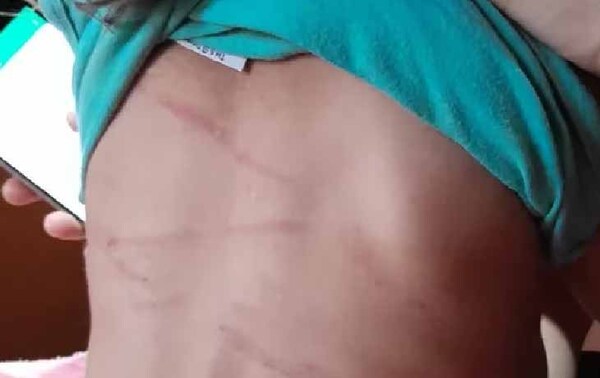 Niña de dos años brutalmente golpeada por su padre en Hernandarias – Prensa 5