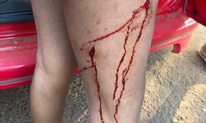 Apuñalan a mujer en intento de asalto