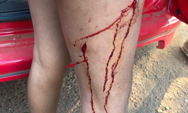 Apuñalan a mujer en intento de asalto