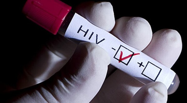 VIH: 12 mil personas se encuentran en tratamiento