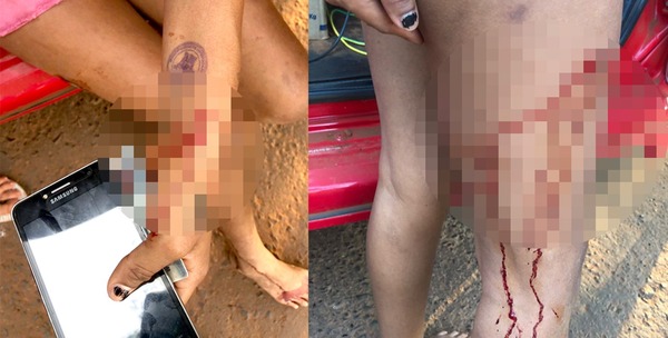 Motochorros son detenidos tras herir a una mujer durante asalto - La Clave
