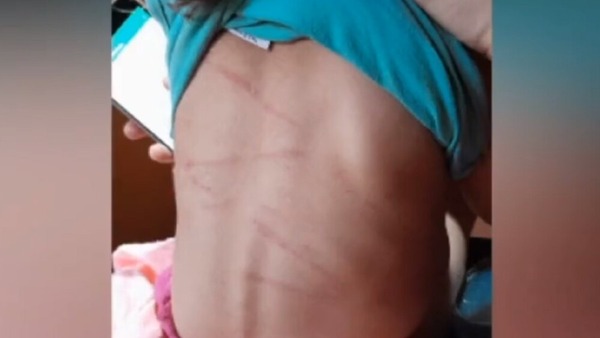Imputan a padre que golpeó a su hija con rama de árbol porque «lloraba»