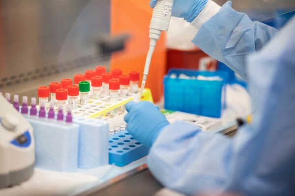 Ministerio de Salud: registran incremento del 40% en casos de Covid-19 - El Independiente