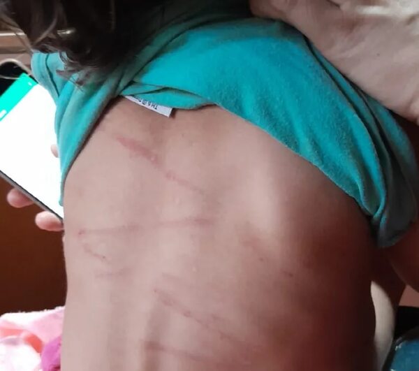Imputan a joven que habría golpeado brutalmente a su hija - Policiales - ABC Color