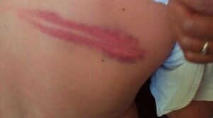 Imputan a joven que habría golpeado brutalmente a su hija de 1 año y 8 meses