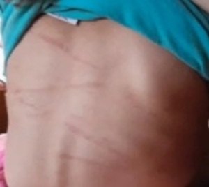 Sujeto es imputado tras salvaje agresión a su pequeña hija - Paraguay.com