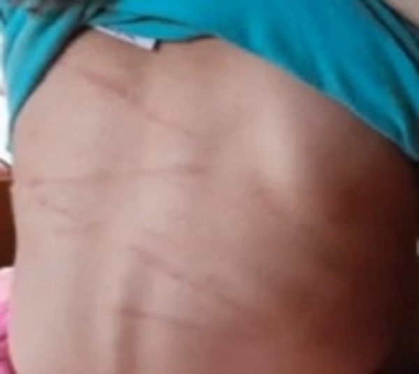 Sujeto es imputado tras salvaje agresión a su pequeña hija - Paraguay.com