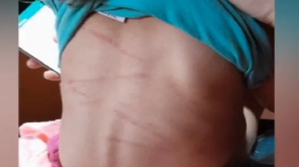 Imputan a sujeto por agredir brutalmente a su hija en Hernandarias - Noticias Paraguay