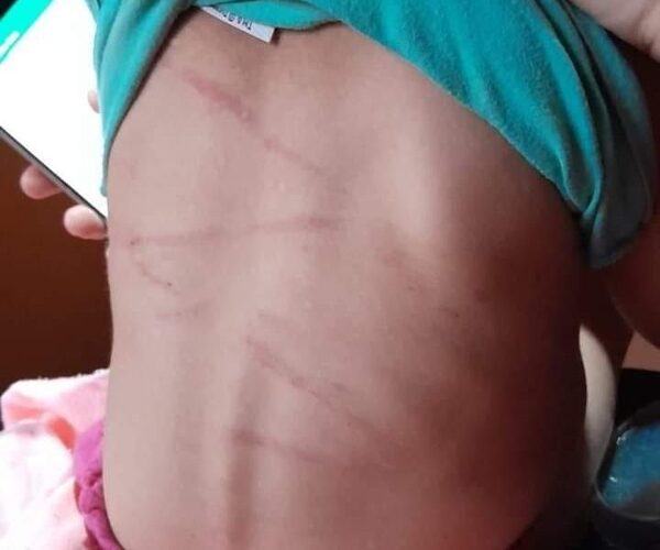 Imputan a violento joven que golpeó brutalmente a su hija de casi 2 años – Diario TNPRESS