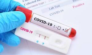 Suman 133 los casos positivos de COVID en una semana