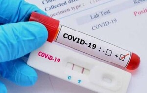 Suman 133 los casos positivos de COVID en una semana – Prensa 5