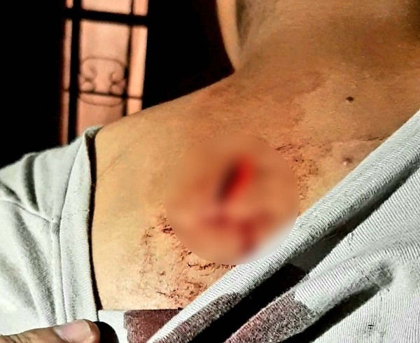 Joven relató que fue herida con arma blanca por su cuñado - Oasis FM 94.3