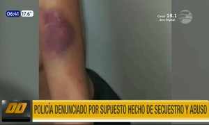Policía denunciado por supuesto hecho de secuestro y abuso | Telefuturo