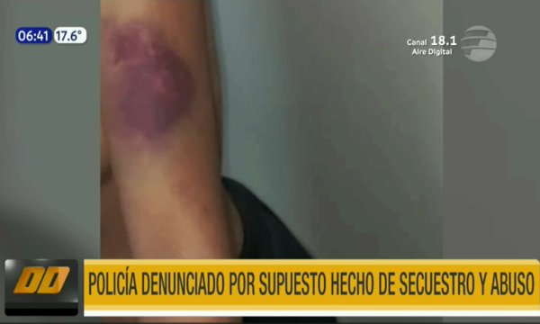 Policía denunciado por supuesto hecho de secuestro y abuso | Telefuturo
