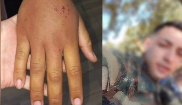 Policía secuestró a su "novia" de 15 años y la golpeó brutalmente - Noticiero Paraguay