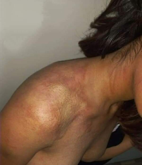 Policía garrotero raptó y golpeó brutalmente a una menor de 15 años | DIARIO PRIMERA PLANA