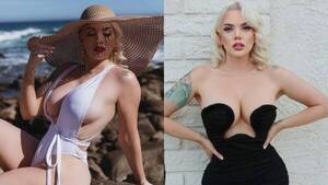 El extraño e increíble motivo por el cual a una modelo le amputaron una pierna