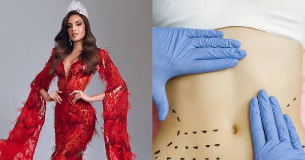 La Nación / ¿Elicena Andrada se sometió a una cirugía estética?