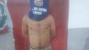 Hincha de Luqueño baleado tras partido está con muerte cerebral