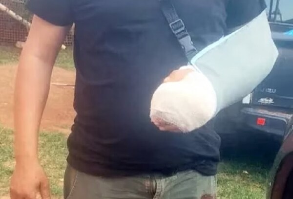 Policías son atacados por supuesto grupo narco en Canindeyú, uno resultó herido - Noticiero Paraguay