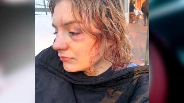 Hombre sindicado de sup. intentar asesinar a una joven tendría problemas psiquiátricos