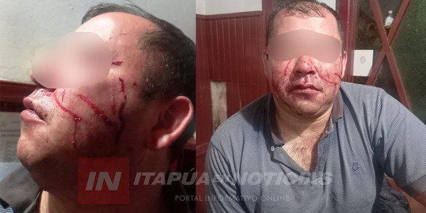 HOMBRE DENUNCIÓ QUE SU PAREJA LO AGREDIÓ Y LE PRODUJO HERIDAS - Itapúa Noticias