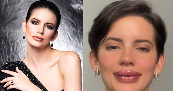 La Nación / La miss Jazmín de la Sierra es criticada por retoque en los labios