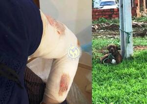 Pitbull mordió a dos predicadoras de testigos de Jehová •