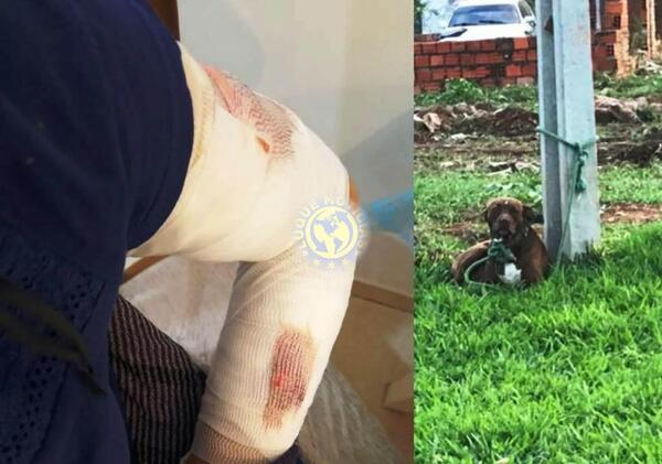 Pitbull mordió a dos predicadoras de testigos de Jehová •