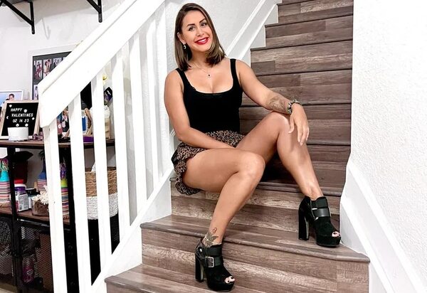 Jessica Sly y su mala experiencia tras una cirugía estética: “Duele verme al espejo” - Gente - ABC Color
