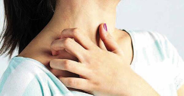 La Nación / Dermatitis atópica: nuevos abordajes para una molestia persistente